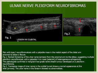 Presentation1.pptx, ultrasound examination of the elbow joint.