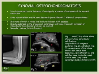 Presentation1.pptx, ultrasound examination of the elbow joint.