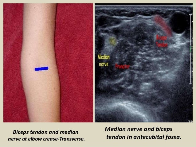 Presentation1.pptx, ultrasound examination of the elbow joint.
