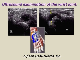 Ultrasound examination of the wrist joint.
Dr/ ABD ALLAH NAZEER. MD.
 