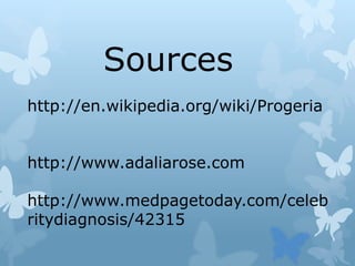 http://en.wikipedia.org/wiki/Progeria
http://www.adaliarose.com
http://www.medpagetoday.com/celeb
ritydiagnosis/42315
Sources
 