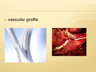  vascular grafts
 