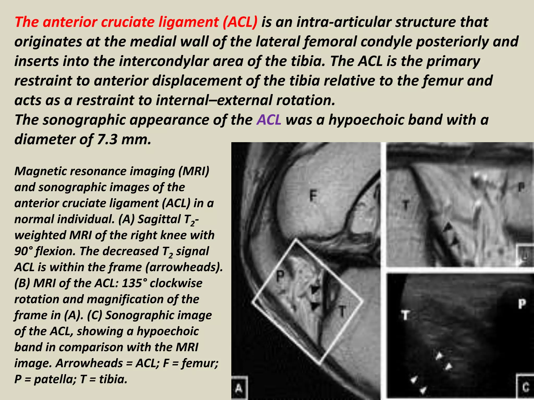 Acl External Rotation Presentation1.pptx, ultrasound examination of the knee joint. | PPTX