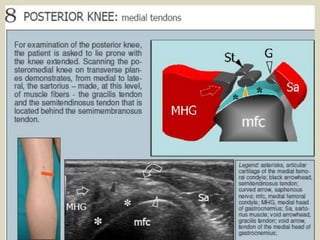 Presentation1.pptx, ultrasound examination of the knee joint. | PPTX