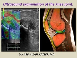 Dr/ ABD ALLAH NAZEER. MD
Ultrasound examination of the knee joint.
 