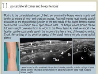 Ultrasound prepatellar bursitis (a) and a septal pattern (b)
 