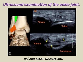 Ultrasound examination of the ankle joint.
Dr/ ABD ALLAH NAZEER. MD.
 
