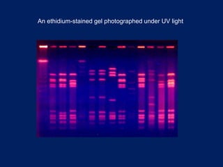 An ethidium-stained gel photographed under UV light
 