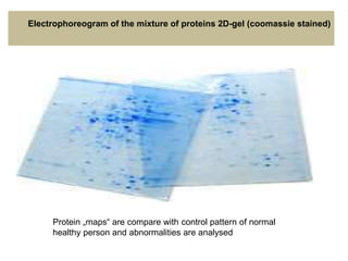 Protein „maps“ are compare with control pattern of normal
healthy person and abnormalities are analysed
Electrophoreogram of the mixture of proteins 2D-gel (coomassie stained)
 