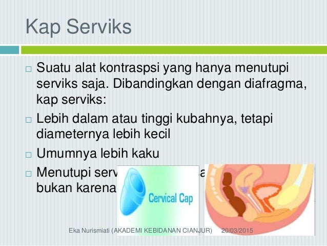 Alat Kontrasepsi Alamiah dengan Alat