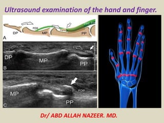 Dr/ ABD ALLAH NAZEER. MD.
Ultrasound examination of the hand and finger.
 