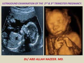 ULTRASOUND EXAMINATION OF THE 2nd & 3rd TRIMESTER PREGNANCY.
Dr/ ABD ALLAH NAZEER. MD.
 