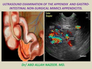 ULTRASOUND EXAMINATION OF THE APPENDIX AND GASTRO-
INTESTINAL NON-SURGICAL MIMICS APPENDICITIS.
Dr/ ABD ALLAH NAZEER. MD.
 