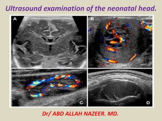 Dr/ ABD ALLAH NAZEER. MD.
Ultrasound examination of the neonatal head.
 