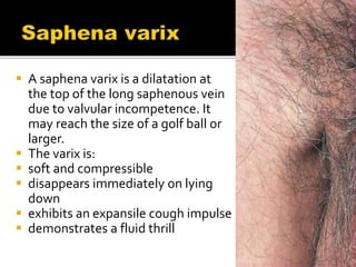  A saphena varix is a dilatation at
the top of the long saphenous vein
due to valvular incompetence. It
may reach the size of a golf ball or
larger.
 The varix is:
 soft and compressible
 disappears immediately on lying
down
 exhibits an expansile cough impulse
 demonstrates a fluid thrill
 