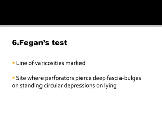 6.Fegan’s test
 Line of varicosities marked
 Site where perforators pierce deep fascia-bulges
on standing circular depressions on lying
 