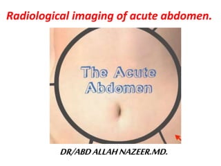 DR/ABDALLAHNAZEER.MD.
Radiological imaging of acute abdomen.
 