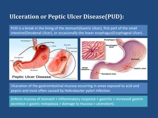 Ulceration or Peptic Ulcer Disease(PUD):
PUD is a break in the lining of the stomach(Gastric Ulcer), first part of the small
intestine(Deodenal Ulcer), or occasionally the lower esophagus(Esophageal Ulcer).
Ulceration of the gastrointestinal mucosa occurring in areas exposed to acid and
pepsin and most often caused by Helicobacter pylori infection.
(Infects mucosa of stomach > inflammatory response > gastritis > increased gastrin
secretion > gastric metaplasia > damage to mucosa > ulceration).
 