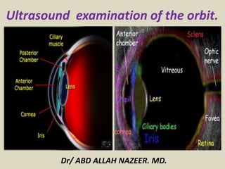 Ultrasound examination of the orbit.
Dr/ ABD ALLAH NAZEER. MD.
 