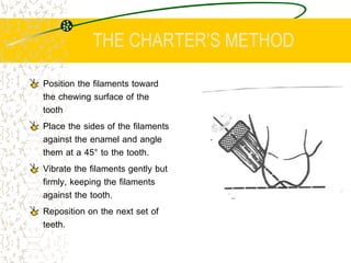 THE CHARTER’S METHOD
Position the filaments toward
the chewing surface of the
tooth
Place the sides of the filaments
again...