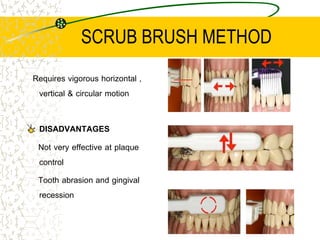 SCRUB BRUSH METHOD
Requires vigorous horizontal ,
vertical & circular motion
DISADVANTAGES
Not very effective at plaque
co...