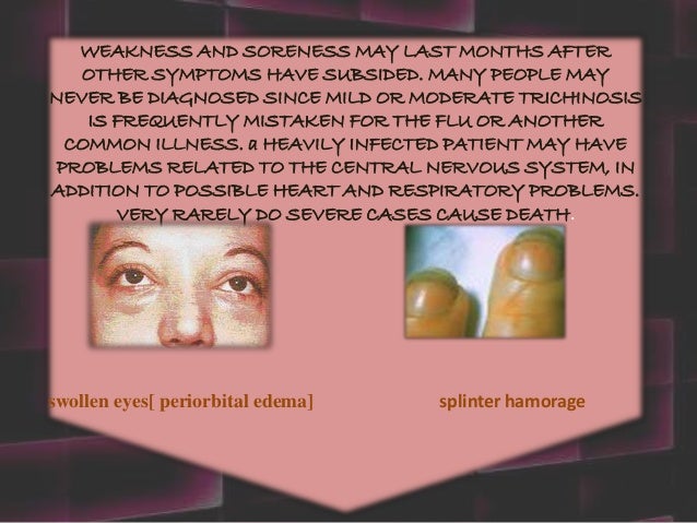Trichinella Spiralis In Humans