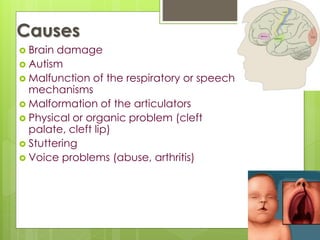 Causes
 Brain damage
 Autism
 Malfunction of the respiratory or speech
mechanisms
 Malformation of the articulators
 Physical or organic problem (cleft
palate, cleft lip)
 Stuttering
 Voice problems (abuse, arthritis)
 