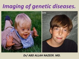 Imaging of genetic diseases.
Dr/ ABD ALLAH NAZEER. MD.
 