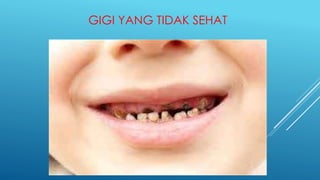 GIGI YANG TIDAK SEHAT
 