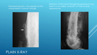 osteosarcoma | PPTX | Bone and Joint Conditions | Diseases and Conditions
