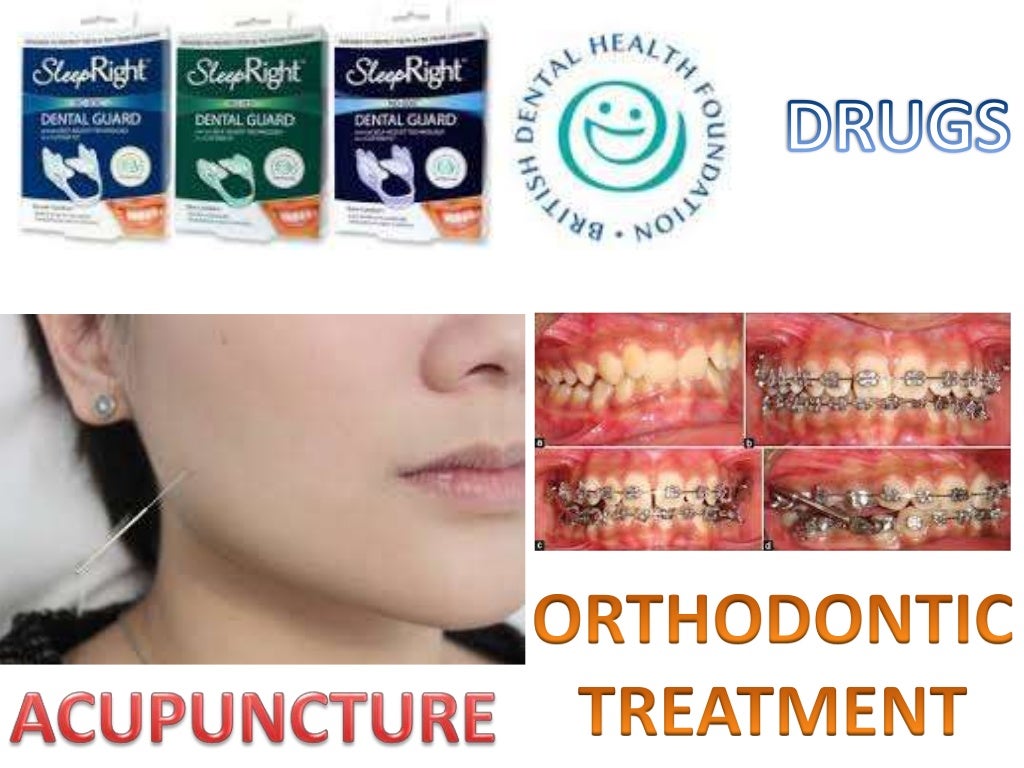 MANAGEMENT OF BRUXISM, LIP BITING AND MASOCHISTIC HABITS