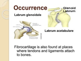 Occurrence
Labrum glenoidale
Labrum acetabulare
Fibrocartilage is also found at places
where tendons and ligaments attach
to bones.
 