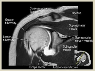 Presentation1.pptx, radiological anatomy of the shoulder joint. | PPTX