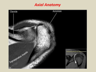 Axial Anatomy
 