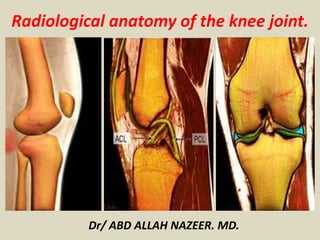 Radiological anatomy of the knee joint.
Dr/ ABD ALLAH NAZEER. MD.
 