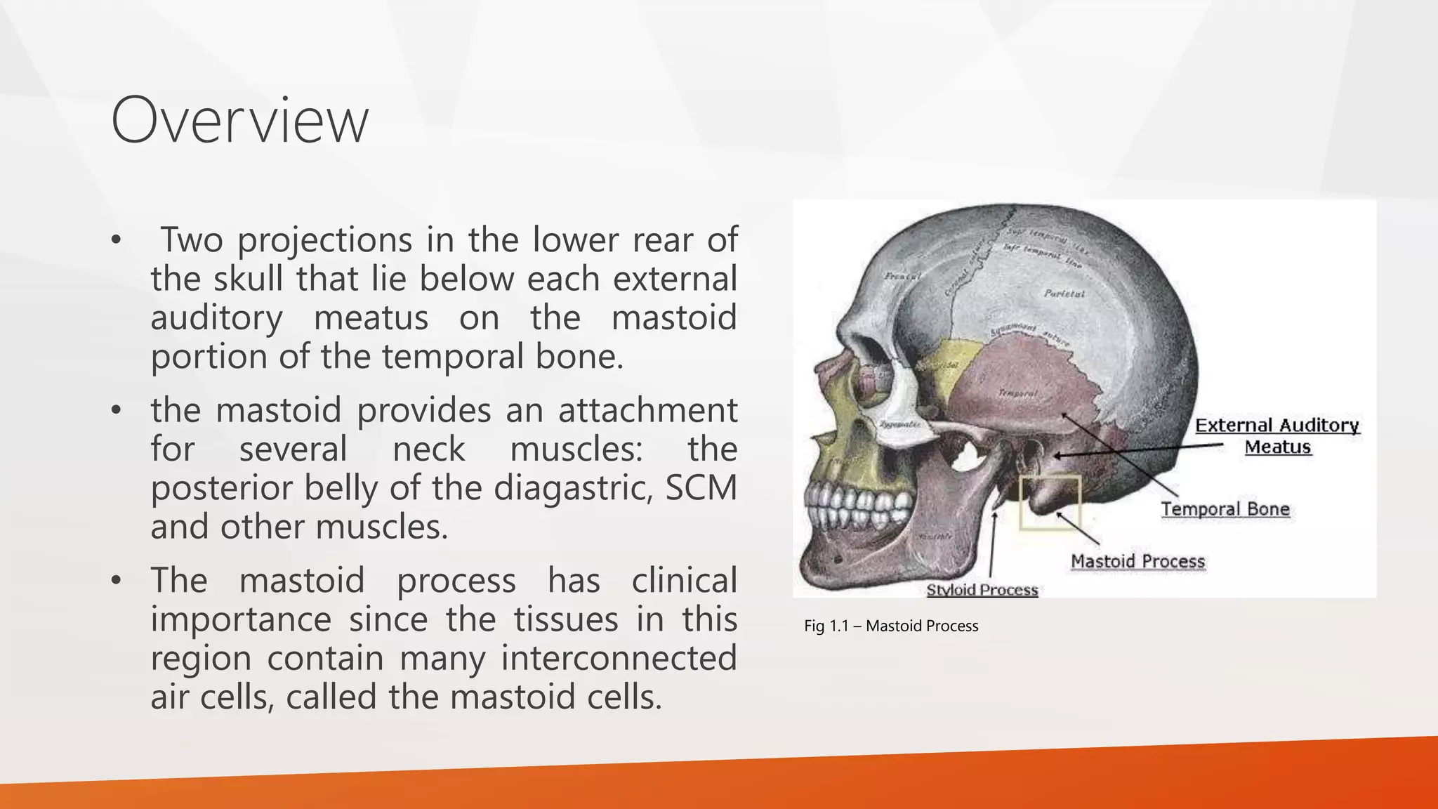Overview
• Two projections in the lower rear of
the skull that lie below each external
auditory meatus on the mastoid
portion of the temporal bone.
• the mastoid provides an attachment
for several neck muscles: the
posterior belly of the diagastric, SCM
and other muscles.
• The mastoid process has clinical
importance since the tissues in this
region contain many interconnected
air cells, called the mastoid cells.
Fig 1.1 – Mastoid Process
 