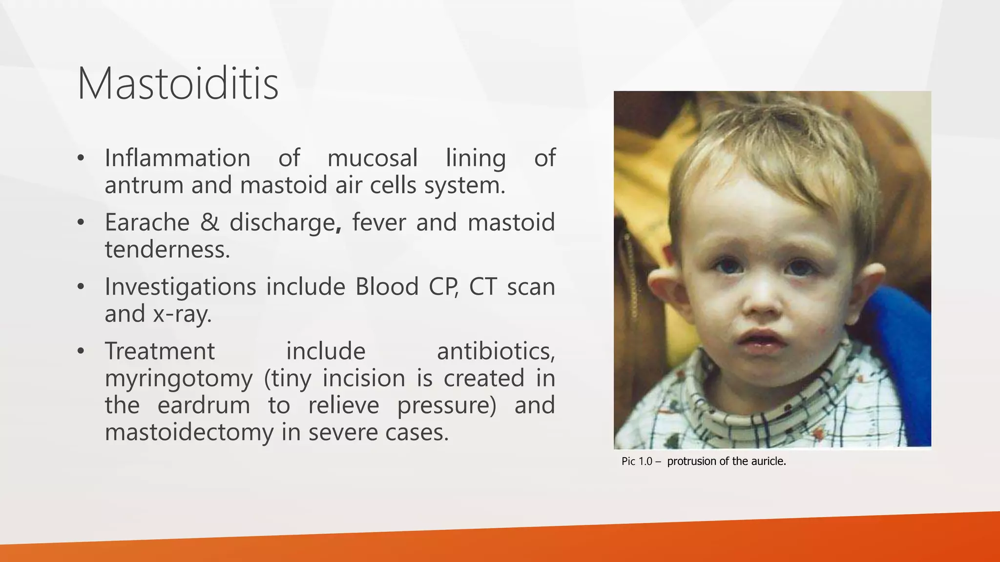 Mastoiditis
• Inflammation of mucosal lining of
antrum and mastoid air cells system.
• Earache & discharge, fever and mastoid
tenderness.
• Investigations include Blood CP, CT scan
and x-ray.
• Treatment include antibiotics,
myringotomy (tiny incision is created in
the eardrum to relieve pressure) and
mastoidectomy in severe cases.
Pic 1.0 – protrusion of the auricle.
 