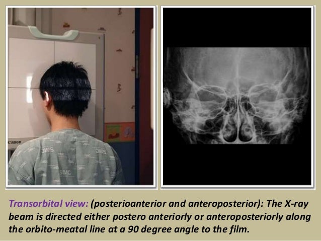Presentation1 Pptx Radiological Anatomy Of The Petrous Bone Presentation1 Pptx Radiological Anatomy Of The Petrous Bone