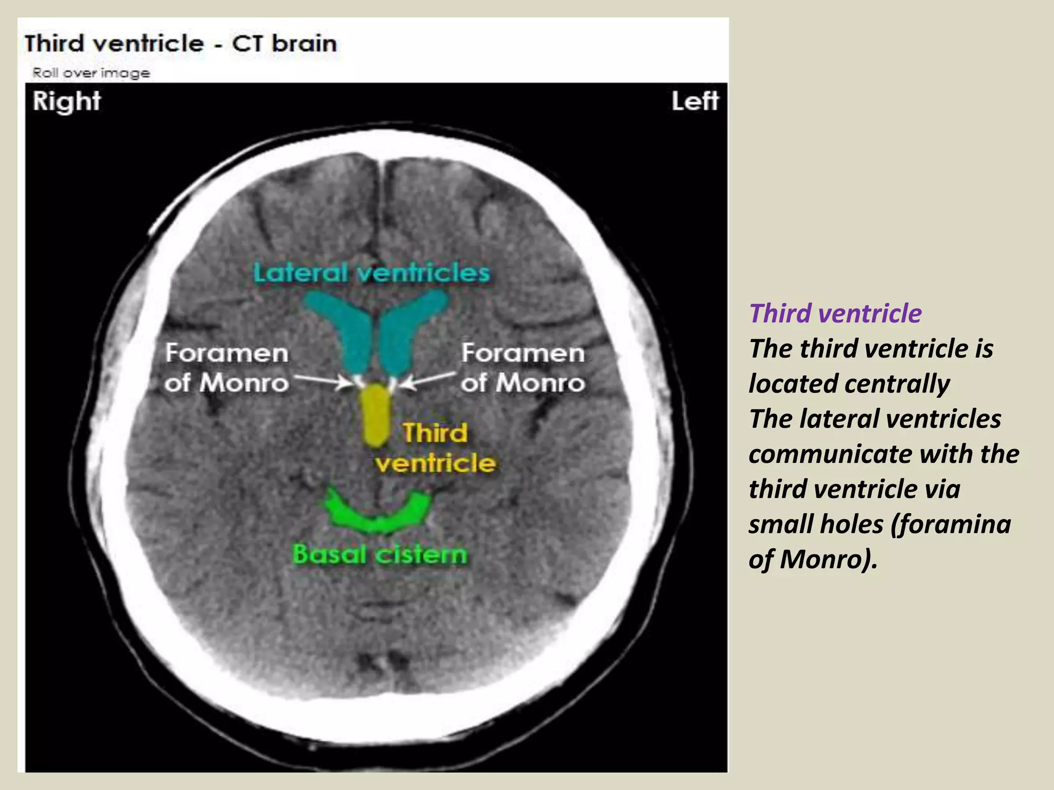 Presentation1.pptx, radiological anatomy of the brain. | PPTX