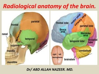 Radiological anatomy of the brain.
Dr/ ABD ALLAH NAZEER. MD.
 