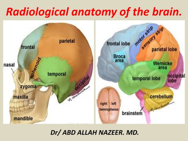 Presentation1.pptx, radiological anatomy of the brain. | PPTX | Brain ...