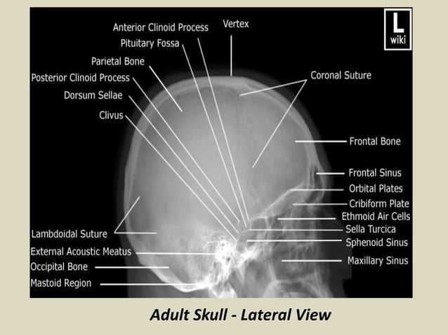 Presentation1.pptx, radiological anatomy of the brain. | PPTX | Brain ...