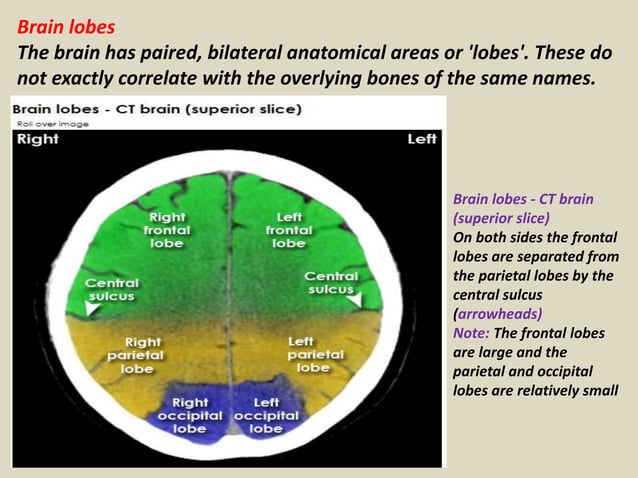 Presentation1.pptx, radiological anatomy of the brain. | PPTX | Brain ...