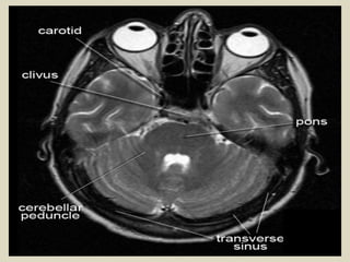 Cardunculus Brain Presentation1.pptx, radiological anatomy of the brain. | PPTX