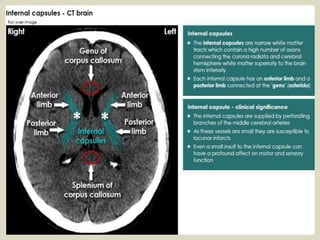 Cerebral vascular territories
Different areas of the brain are supplied by the
anterior, middle and posterior cerebral art...
