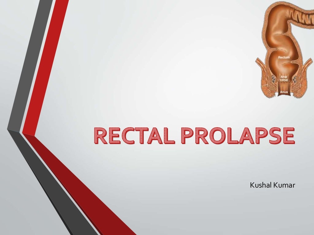 RECTAL PROLAPSE