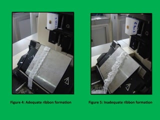 Figure 4: Adequate ribbon formation Figure 5: Inadequate ribbon formation
 