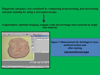 Diagnostic adequacy was examined by comparing preprocessing, post-processing
and post staining by using a stereomicroscope.
Fragmentation, epithelial stripping, irregular voids and shrinkage were examined by single
inter-observer.
Figure 7: Measurement for shrinkage in cross-
sectional surface area
after staining
stereomicroscope
 