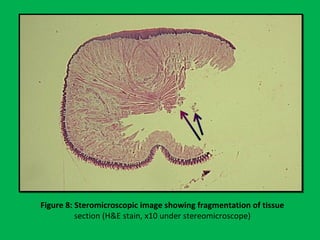 Figure 8: Steromicroscopic image showing fragmentation of tissue
section (H&E stain, x10 under stereomicroscope)
 