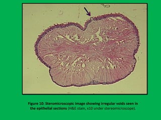 Figure 10: Steromicroscopic image showing irregular voids seen in
the epithelial sections (H&E stain, x10 under stereomicroscope).
 